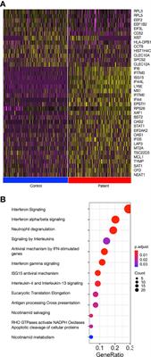 A Novel Type I Interferon Primed Dendritic Cell Subpopulation in TREX1 Mutant Chilblain Lupus Patients